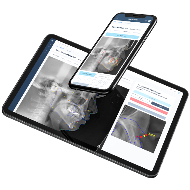 WebCeph 인공지능 트레이싱 진단 분석